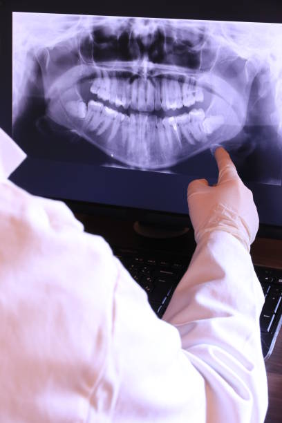 Best Dentist for Tooth Abscess  in La Harpe, IL