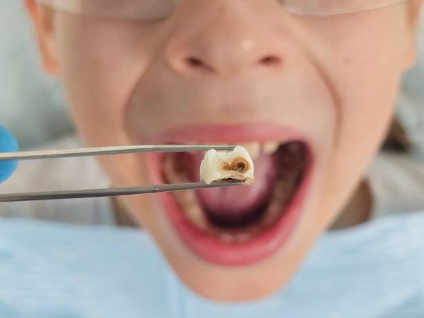 Best Emergency Dentist for Kids  in La Harpe, IL