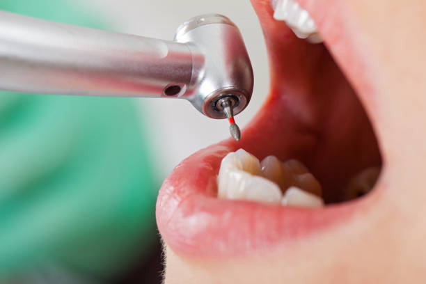 Best Root Canal Emergency Dentist  in La Harpe, IL